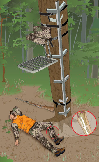 Illustration of a hunter's fall from an elevated stand. 